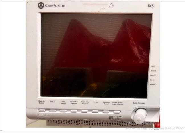 Aparelho médico Ventilador Pulmonar - leilão judicial - Não informado BR - lance mínimo R$ 27.500